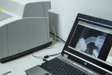 Radiografia computerizata